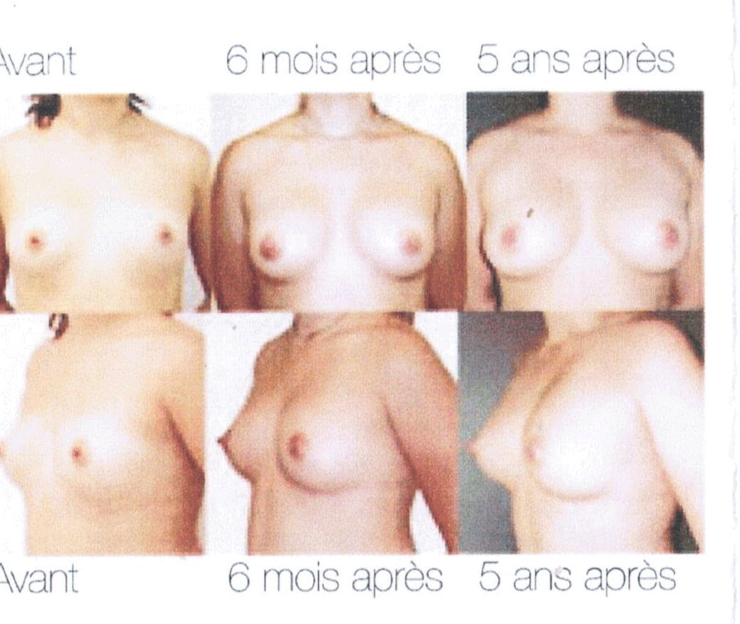 silhouette esthetique